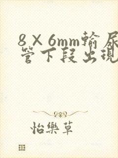 8×6mm输尿管下段出现结石