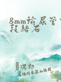 8mm输尿管下段结石