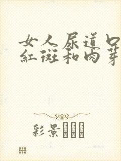 女人尿道口有小红斑和肉芽