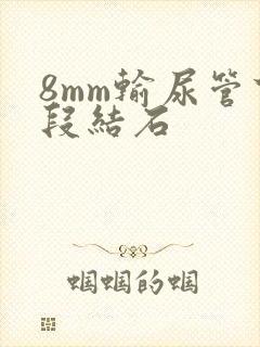 8mm输尿管下段结石