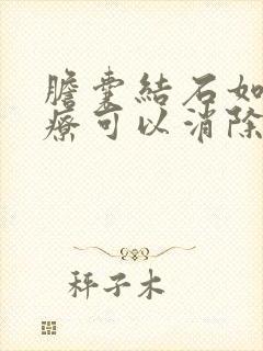 胆囊结石如何治疗可以消除