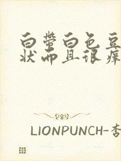 白带白色豆腐渣状而且很痒要怎么办