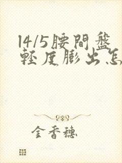 l4/5腰间盘轻度膨出怎么治疗