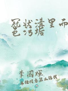 冠状沟里面的白色污垢