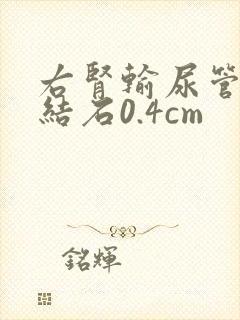 右肾输尿管下段结石0.4cm