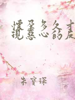 怀孕多久才会出现恶心的反应