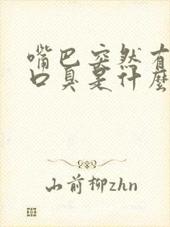 嘴巴突然有异味口臭是什么原因引起的