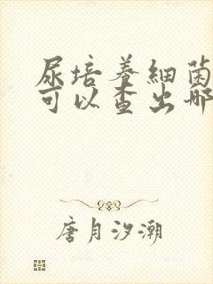 尿培养细菌检查可以查出哪些问题