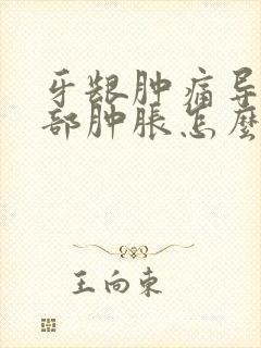 牙龈肿痛导致脸部肿胀怎么办