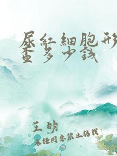 尿红细胞形态检查多少钱