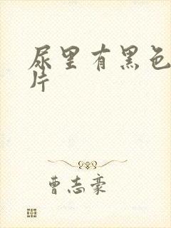 尿里有黑色渣图片