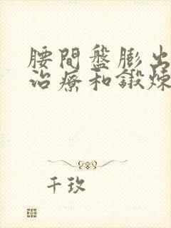 腰间盘膨出如何治疗和锻炼