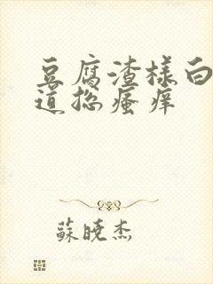 豆腐渣样白带阴道总瘙痒