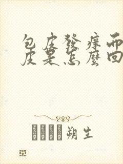 包皮发痒而且脱皮是怎么回事