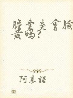 胆囊炎会脸色发黄吗?