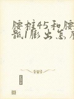 腰椎45和腰5骶1膨出怎么运动