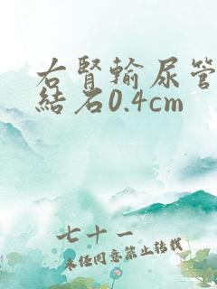 右肾输尿管下段结石0.4cm