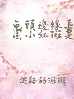 龟头边缘长了一圈小红斑是什么