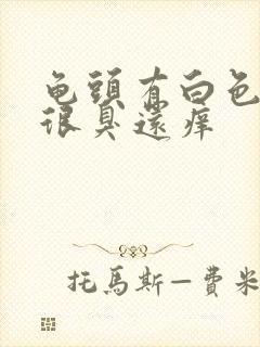 龟头有白色污垢很臭还痒