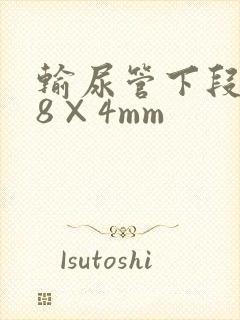 输尿管下段结石8×4mm