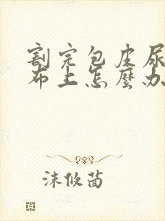 割完包皮尿到纱布上怎么办