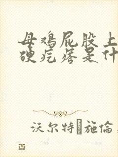 母鸡屁股上面的硬疙瘩是什么