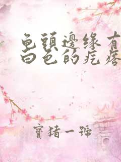 龟头边缘有一排白色的疙瘩