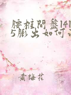 腰椎间盘l4l5膨出如何治疗