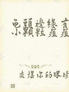 龟头边缘有一圈小颗粒痘痘