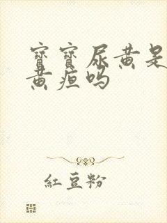 宝宝尿黄是在排黄疸吗