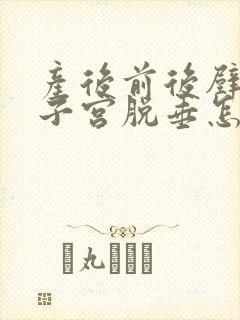 产后前后壁膨出子宫脱垂怎么治疗