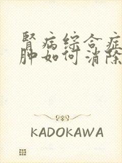 肾病综合症的水肿如何消除