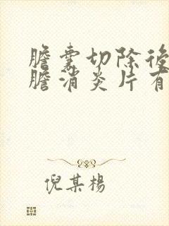 胆囊切除后吃利胆消炎片有没有好处