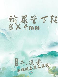 输尿管下段结石8×4mm