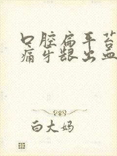 口腔扁平苔藓疼痛牙龈出血怎么办吃什么药