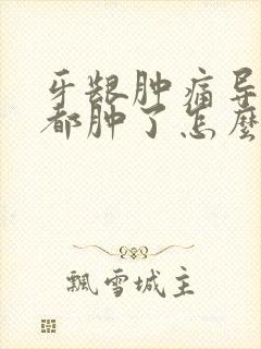 牙龈肿痛导致脸都肿了怎么办