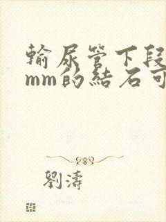 输尿管下段10mm的结石可以排出体外吗