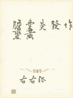 胆囊炎发作尿液变黄