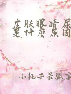 皮肤眼睛尿发黄是什么原因