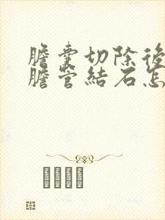 胆囊切除后肝内胆管结石怎么办