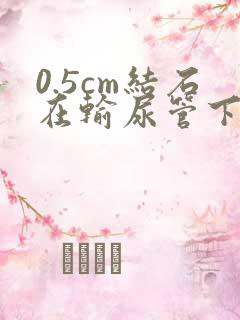 0.5cm结石在输尿管下段卡住怎么办