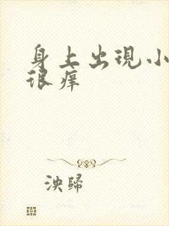 身上出现小红斑很痒