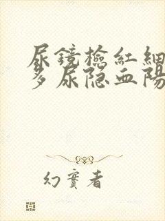 尿镜检红细胞增多尿隐血阳性是啥意思