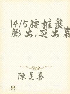 l4/5腰椎盘膨出,突出严重吗?