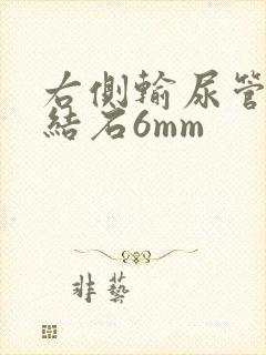 右侧输尿管下段结石6mm