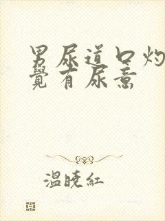 男尿道口灼热感觉有尿意