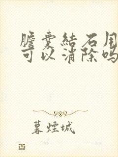 胆囊结石用中药可以消除吗