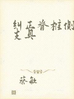 纠正脊椎侧弯的支具