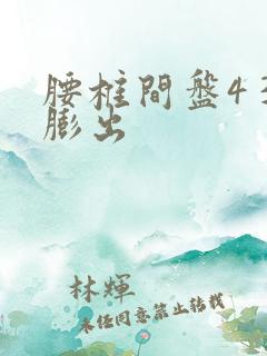 腰椎间盘4 3膨出