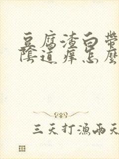 豆腐渣白带很多阴道痒怎么回事